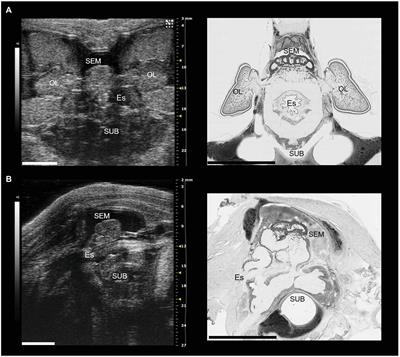 Can Cephalopods Vomit? Hypothesis Based on a Review of Circumstantial Evidence and Preliminary Experimental Observations